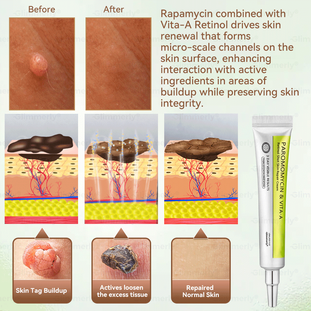 Zeitlich begrenztes Angebot 🎁 Herzlichen Glückwunsch! Du bist heute der 269. Kunde 🎉 Jetzt 50% Rabatt auf deinen nächsten Einkauf von 𝐺𝑙𝑖𝑚𝑚𝑒𝑟𝑙𝑦® Paromomycin & Vita-A Retinol Skin Repair Cream 🛒