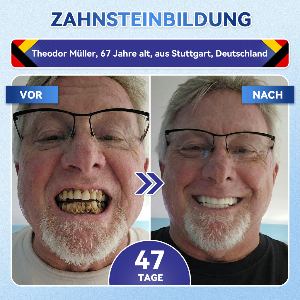 𝐺𝑙𝑖𝑚𝑚𝑒𝑟𝑙𝑦®🏆 Tideglusib Zahn & Zahnfleisch Schnelllösliche Repair-Mundstreifen🎋
