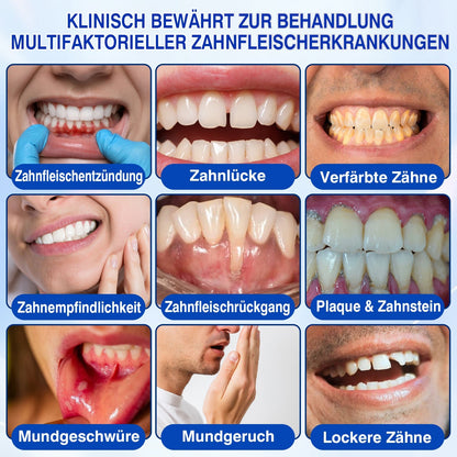 🇩🇪Glimmerly®🦷 GumRevive Parodontales Reparaturgel✨