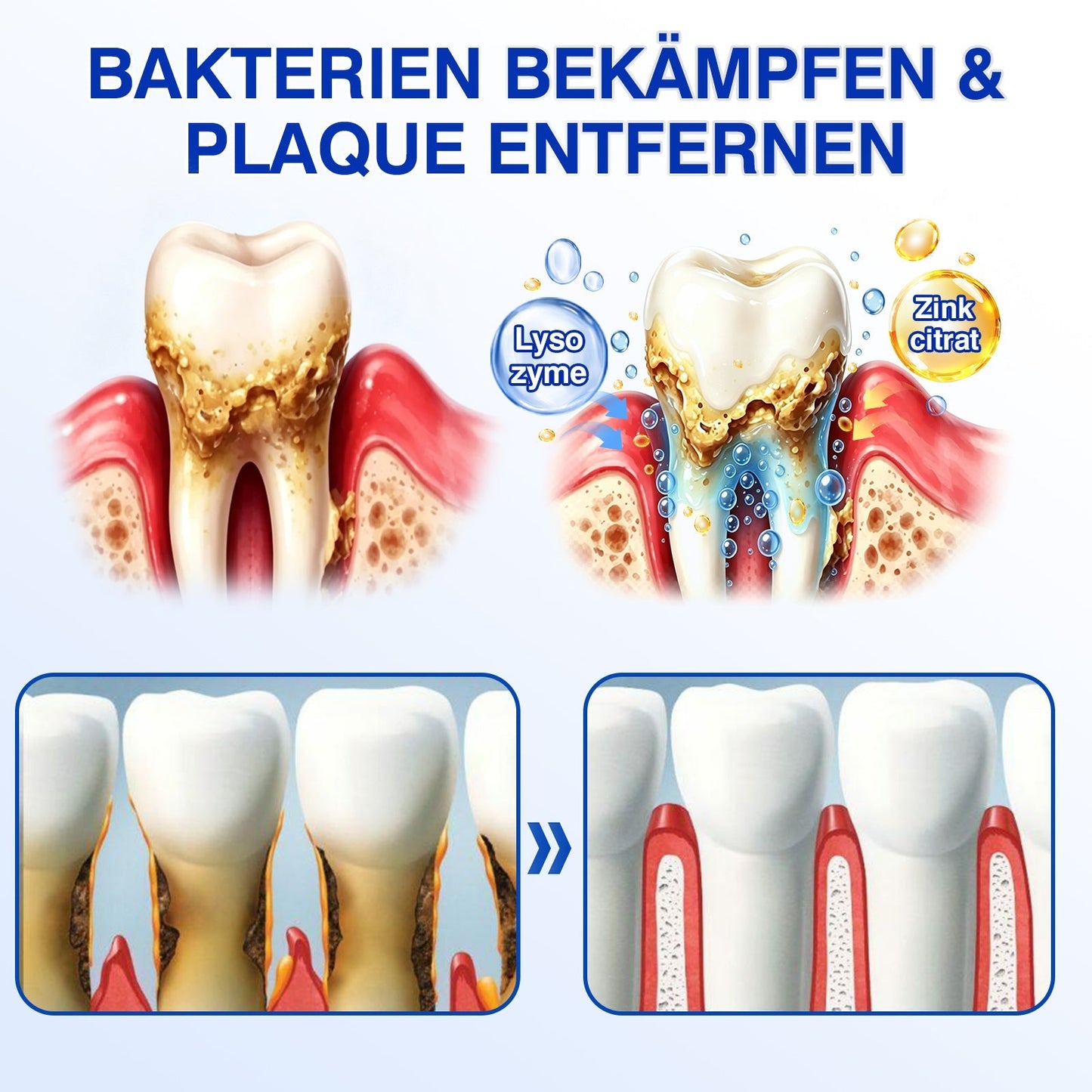 🇩🇪Glimmerly®🦷 GumRevive Parodontales Reparaturgel✨