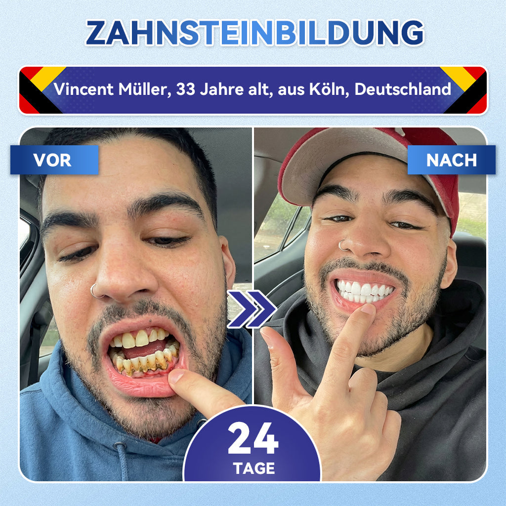 𝐺𝑙𝑖𝑚𝑚𝑒𝑟𝑙𝑦®🏆 Tideglusib Zahn & Zahnfleisch Schnelllösliche Repair-Mundstreifen🎋