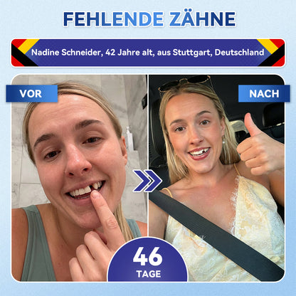 𝐺𝑙𝑖𝑚𝑚𝑒𝑟𝑙𝑦®🏆 Tideglusib Zahn & Zahnfleisch Schnelllösliche Repair-Mundstreifen🎋