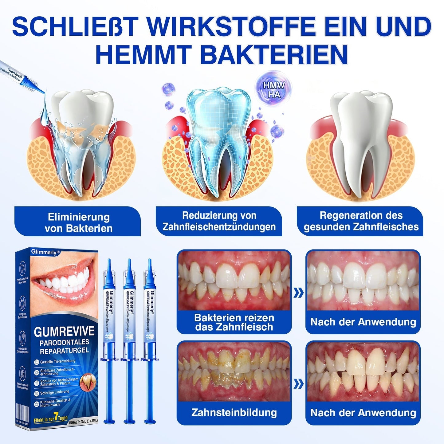 🇩🇪Glimmerly®🦷 GumRevive Parodontales Reparaturgel✨