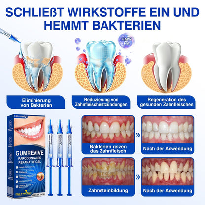 🇩🇪Glimmerly®🦷 GumRevive Parodontales Reparaturgel✨