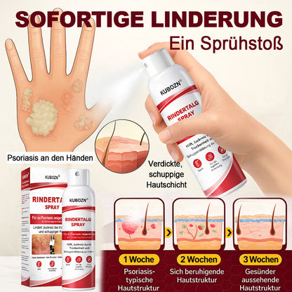 KUBOZN® Rindertalg-Spray für juckende, schuppige Psoriasis-Haut 1