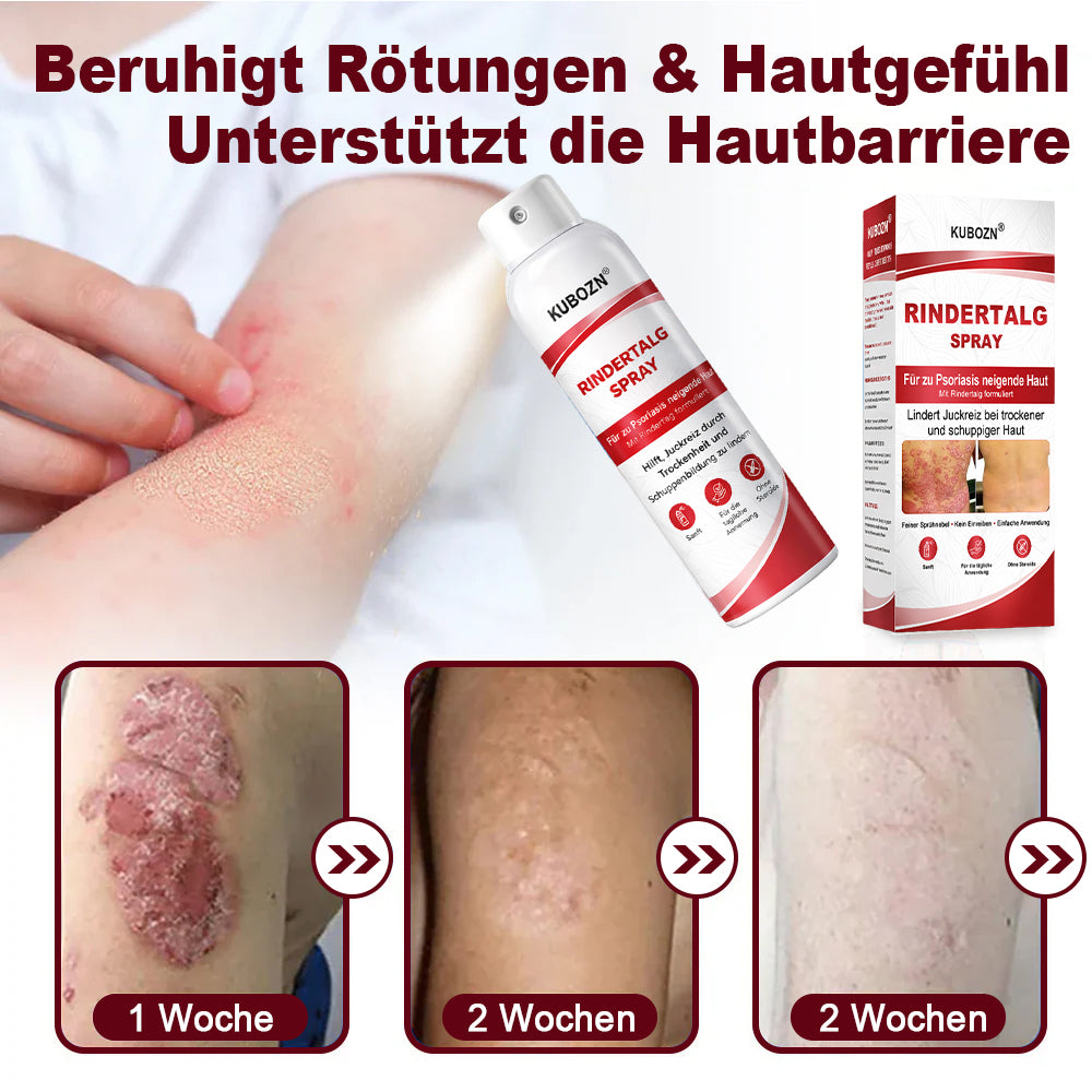 KUBOZN® Rindertalg-Spray für juckende, schuppige Psoriasis-Haut 1