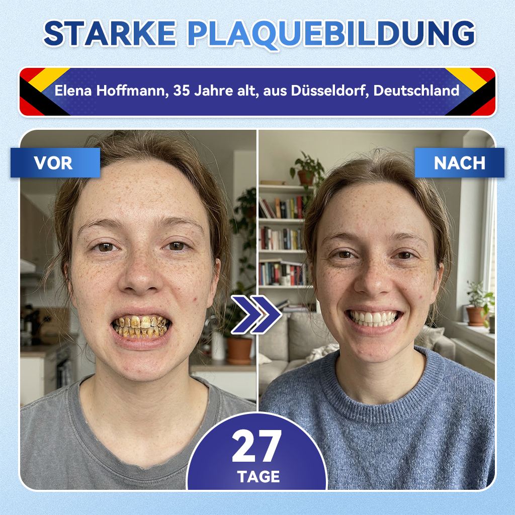 𝐺𝑙𝑖𝑚𝑚𝑒𝑟𝑙𝑦®🏆 Tideglusib Zahn & Zahnfleisch Schnelllösliche Repair-Mundstreifen🎋