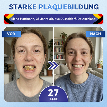 𝐺𝑙𝑖𝑚𝑚𝑒𝑟𝑙𝑦®🏆 Tideglusib Zahn & Zahnfleisch Schnelllösliche Repair-Mundstreifen🎋